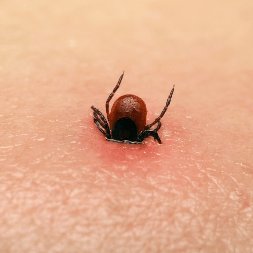 Tick Bite